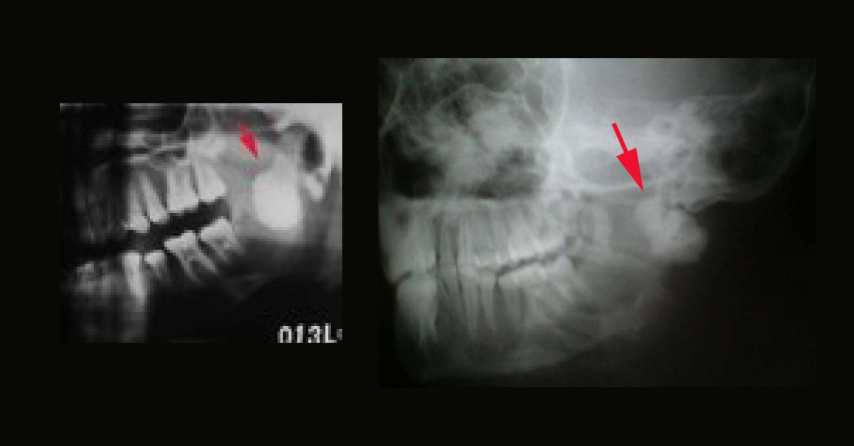 Interpret The Radiologic Findings