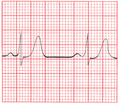 Interpret This ECG