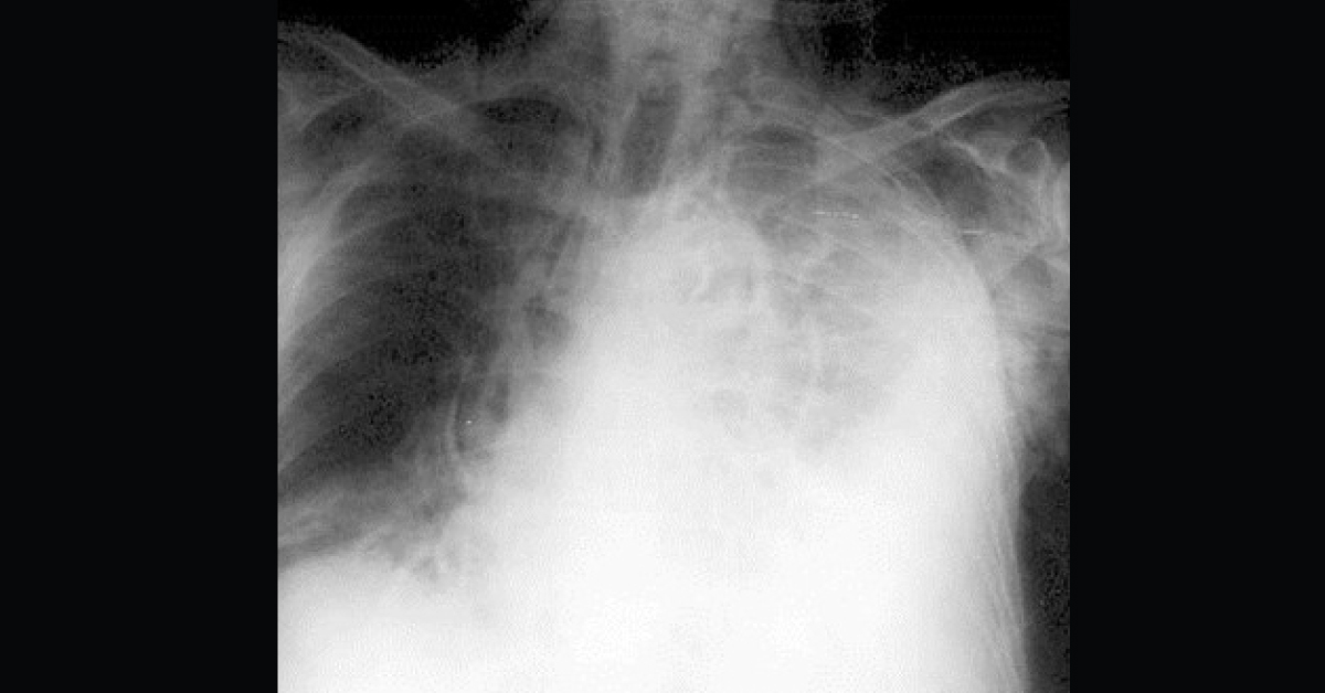 Spot The Condition