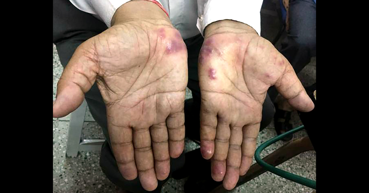 Diagnose This Dermal Condition