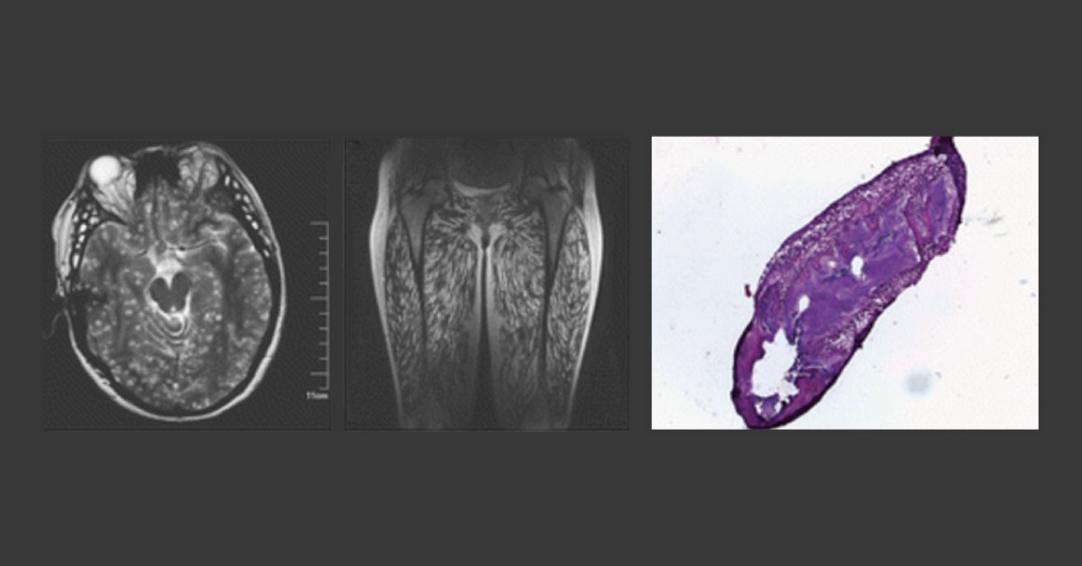 Diagnose The Condition From The Image Panel