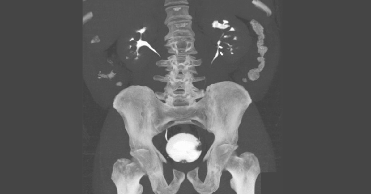 Diagnose from the Radiograph
