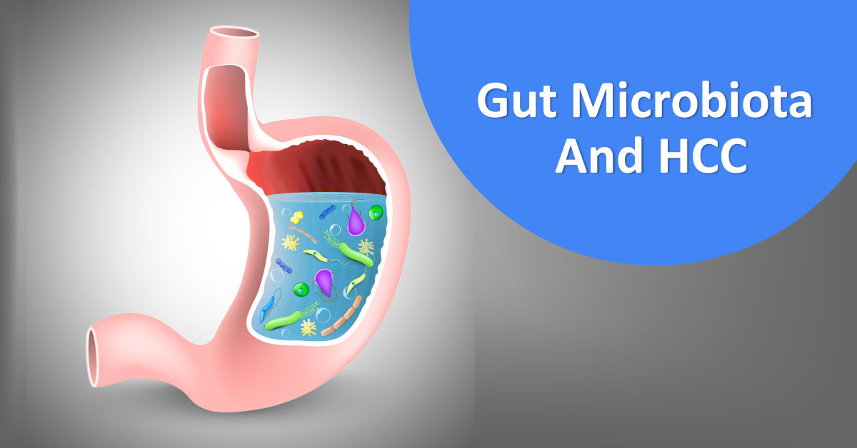 Gut Microbiota And Hepatocellular Carcinoma