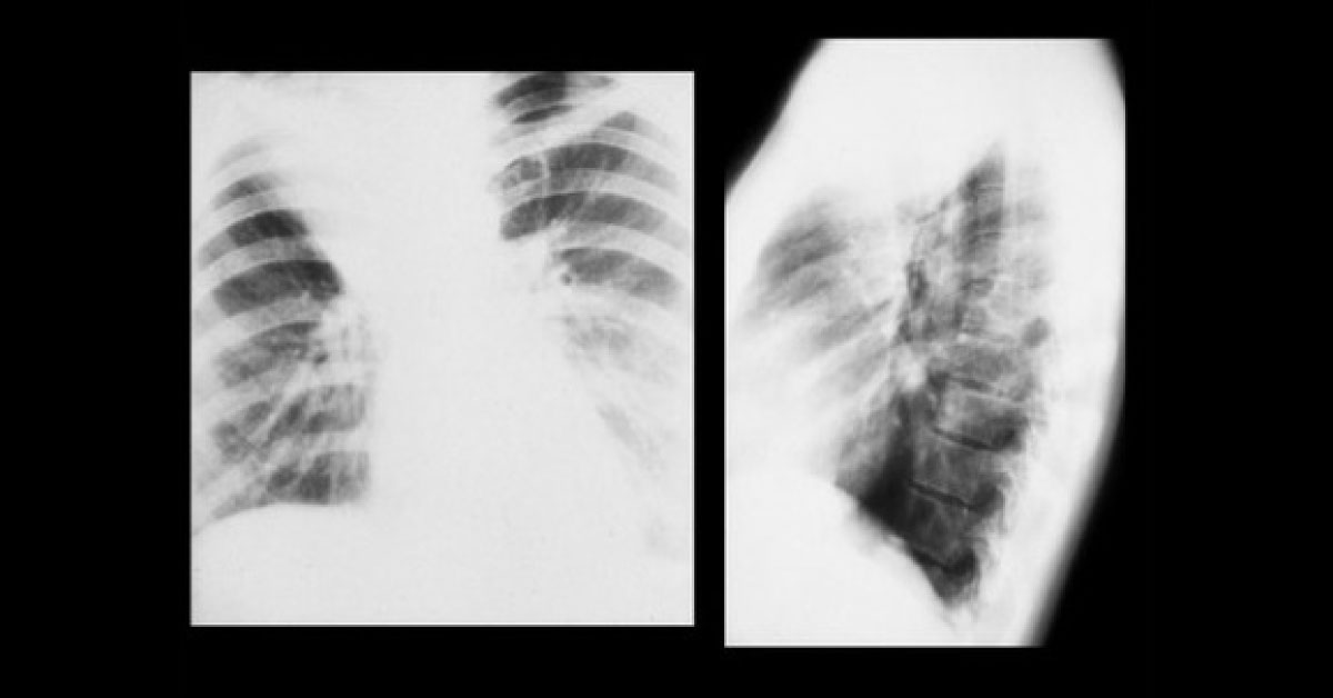Conclude The Diagnosis From Radiograph