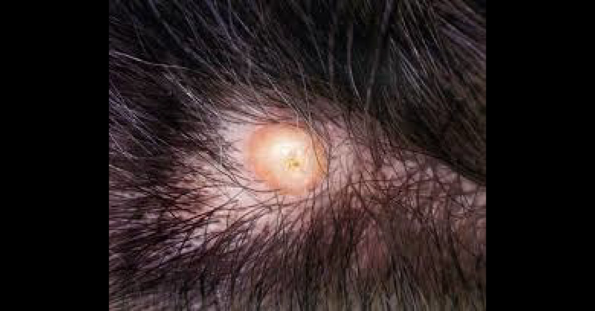 Spot The Dermal Condition