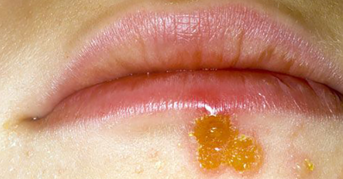 Diagnose The Skin Condition