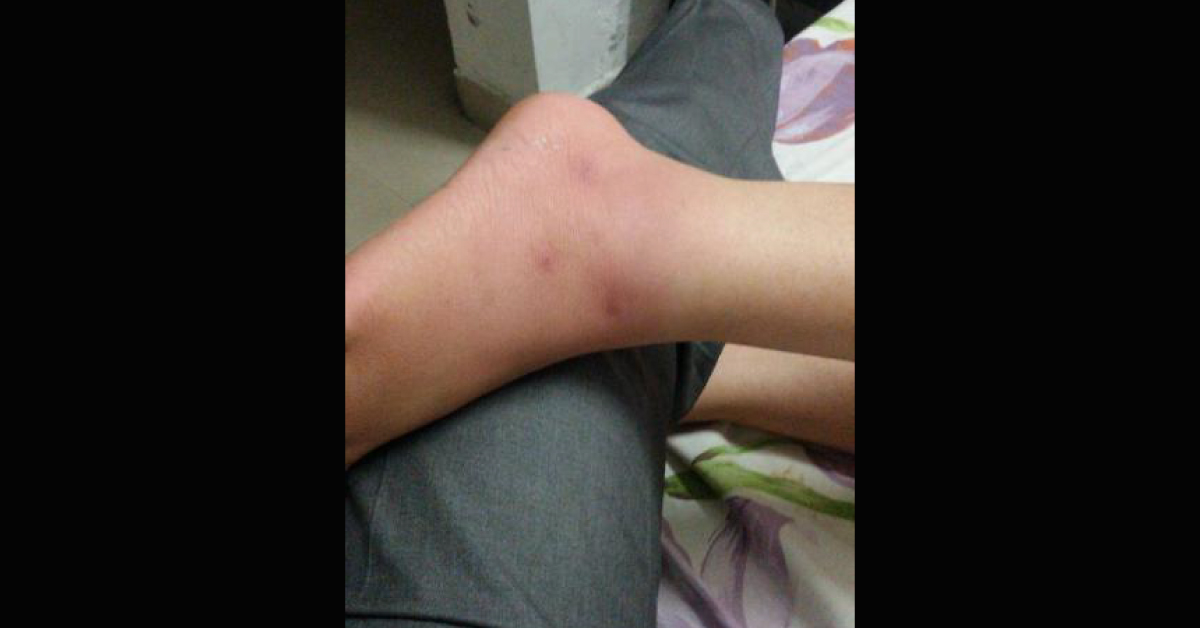  Conclude The Diagnosis From Lesions