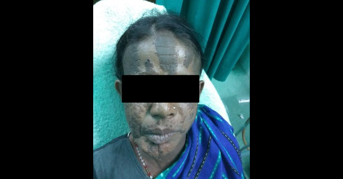 Diagnose The Skin Problem