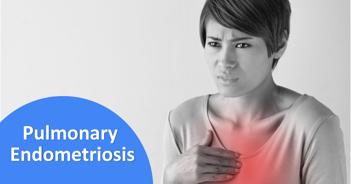 Management Of Pulmonary Endometriosis
