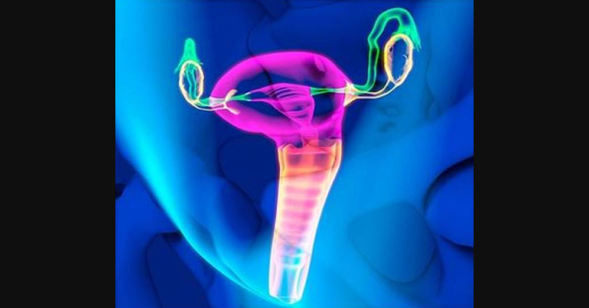 Successful Laparoscopic Uterovaginal Anastomosis For Cervical Agenesis