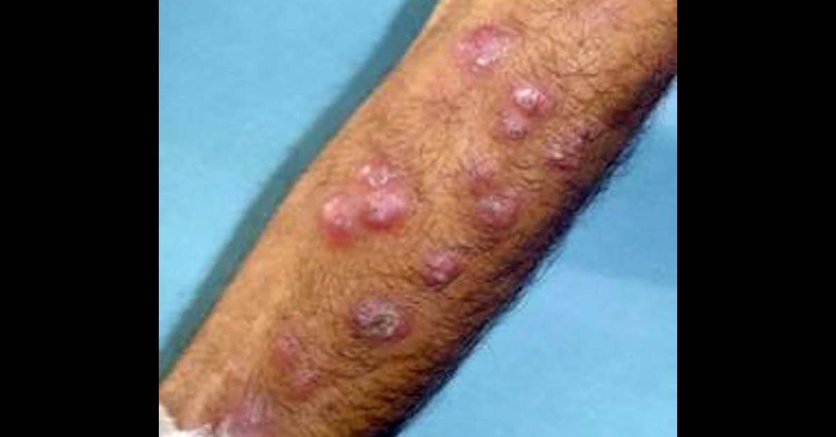 Spot The Dermal Condition