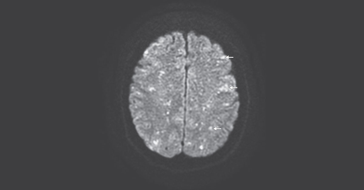Identify Neurological Condition From MRI