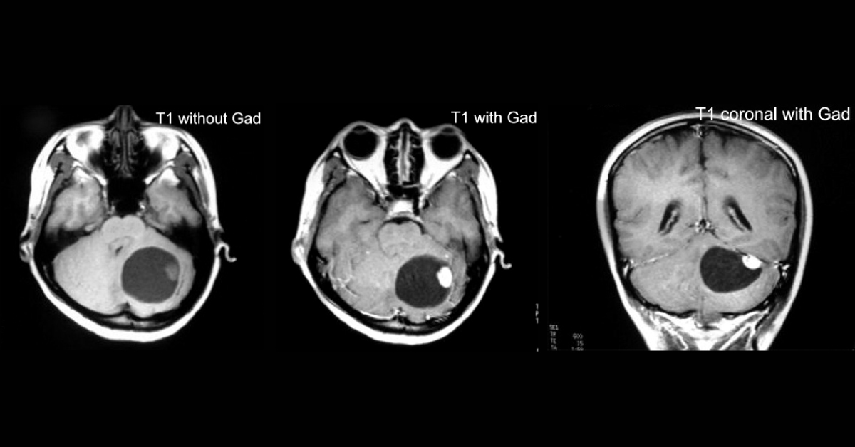 Diagnose The Cause Of Headache