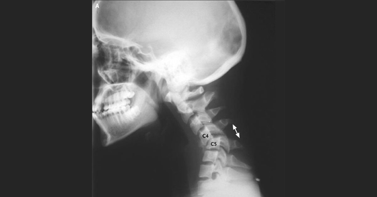 Identify This Condition From Attached Images