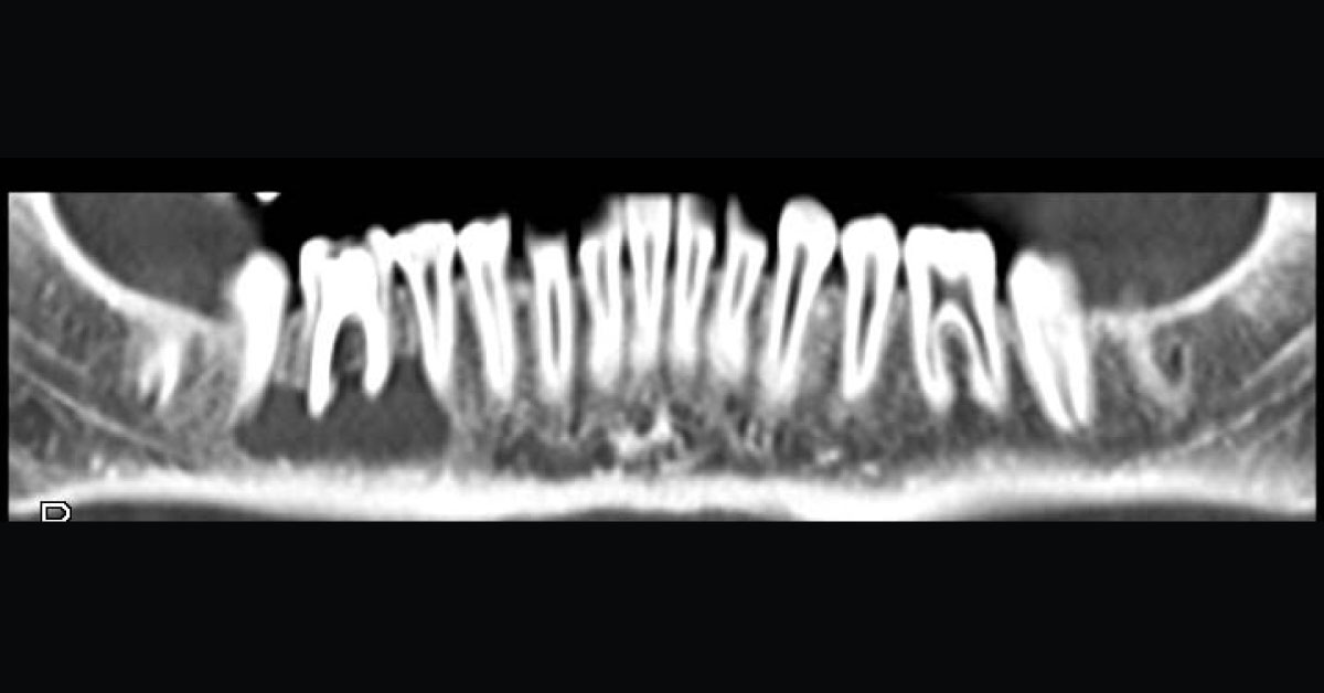 Spot The Dental Abnormality
