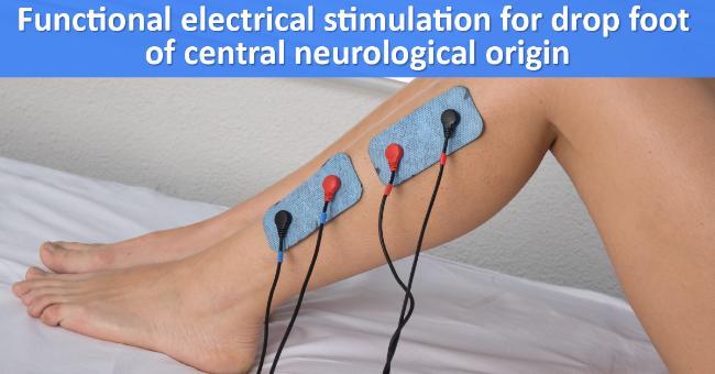 Drop Foot Of Central Neurological Origin: Use of functional electrical stimulation Guidelines