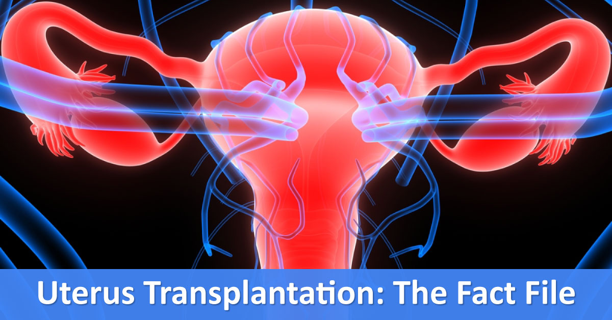 Uterus Transplantation, A Laudable Therapeutic Adventure