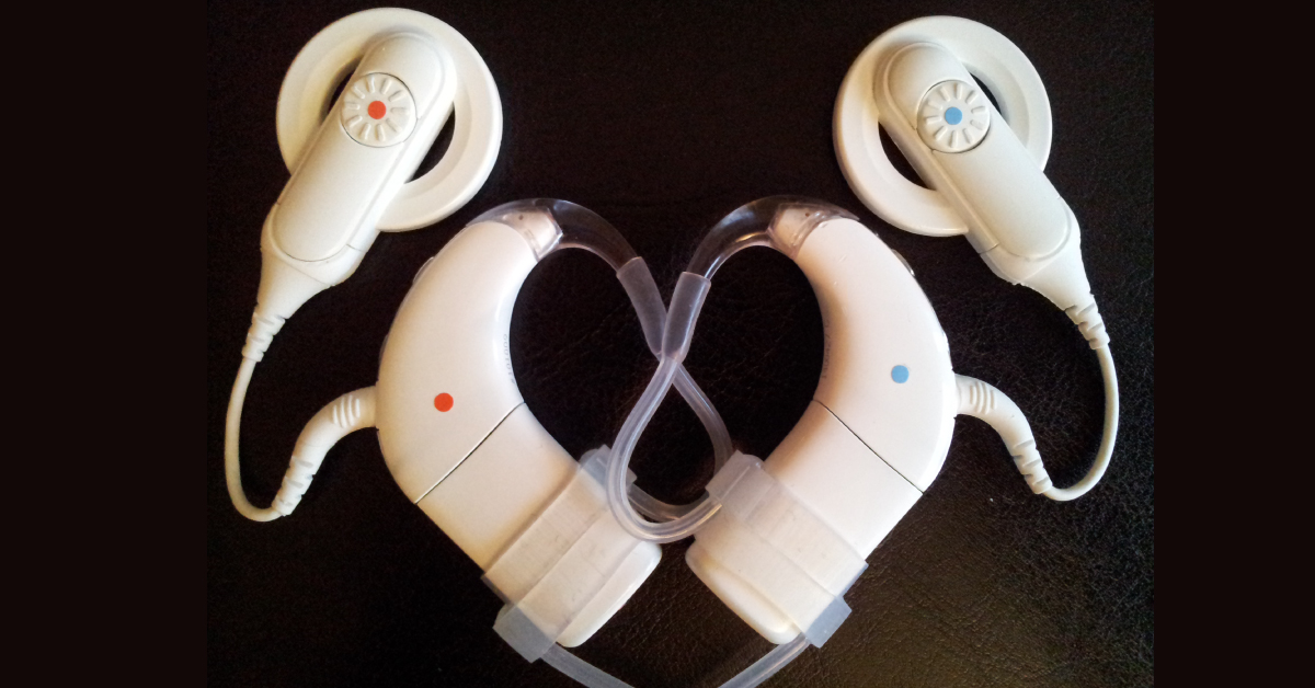 Bilateral Cochlear Implants