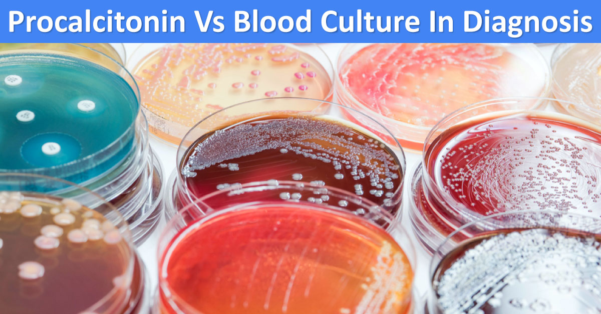 Procalcitonin Vs Blood Culture In Diagnosis And Controlling Antibiotic Prescription