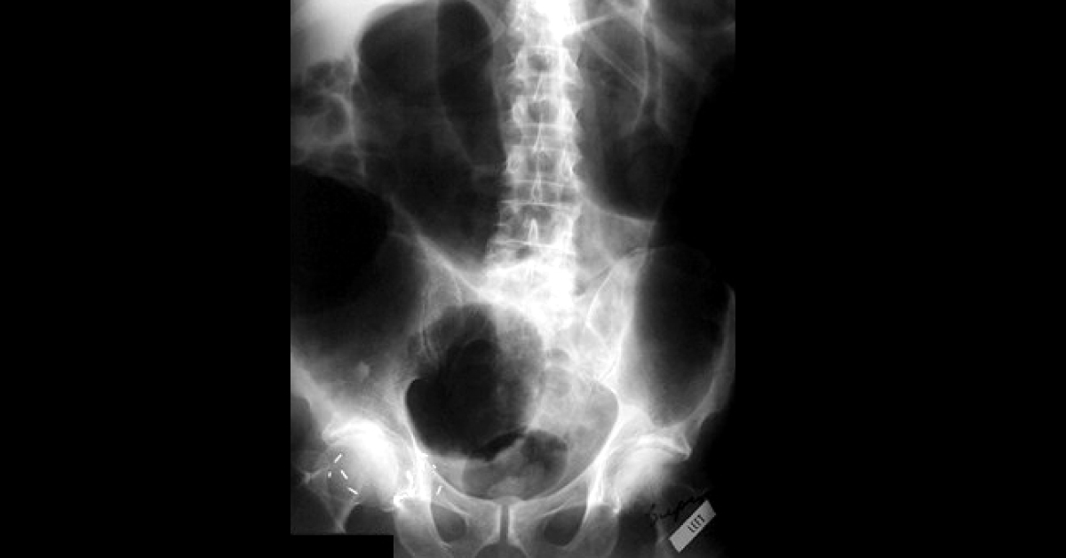 Interpret These Radiologic Findings