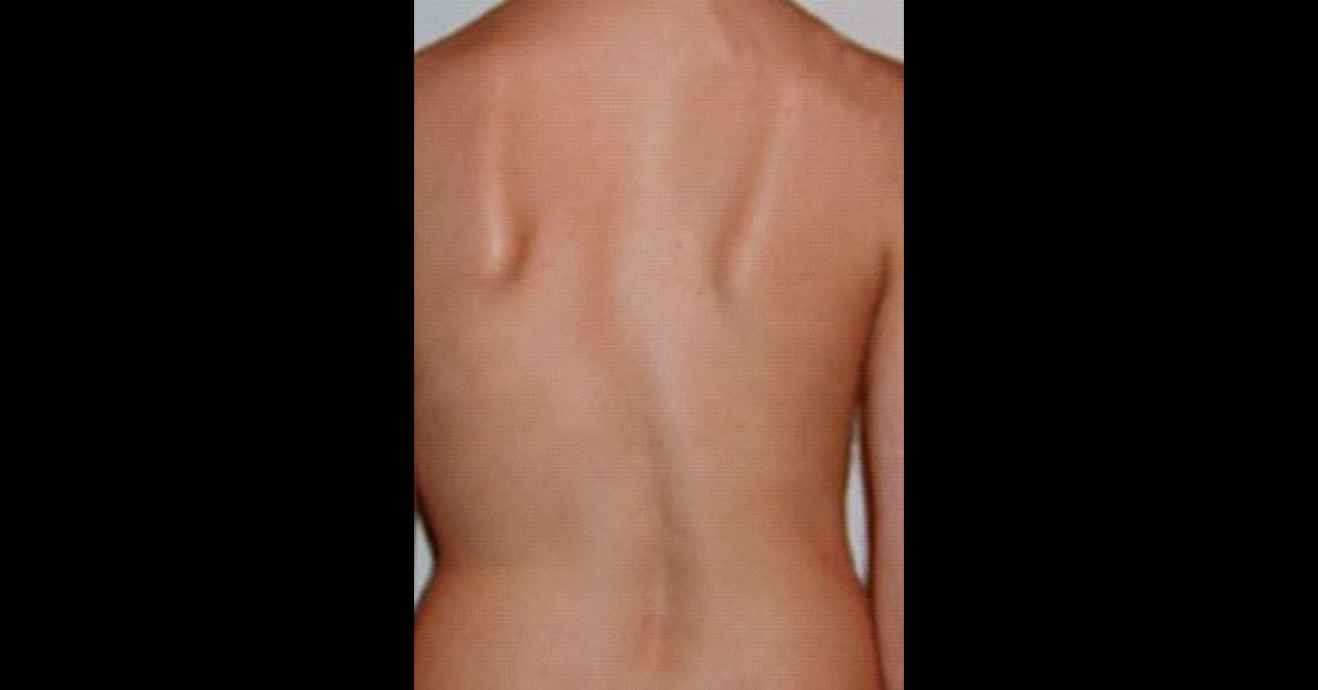 A Young Man with Chest Pain