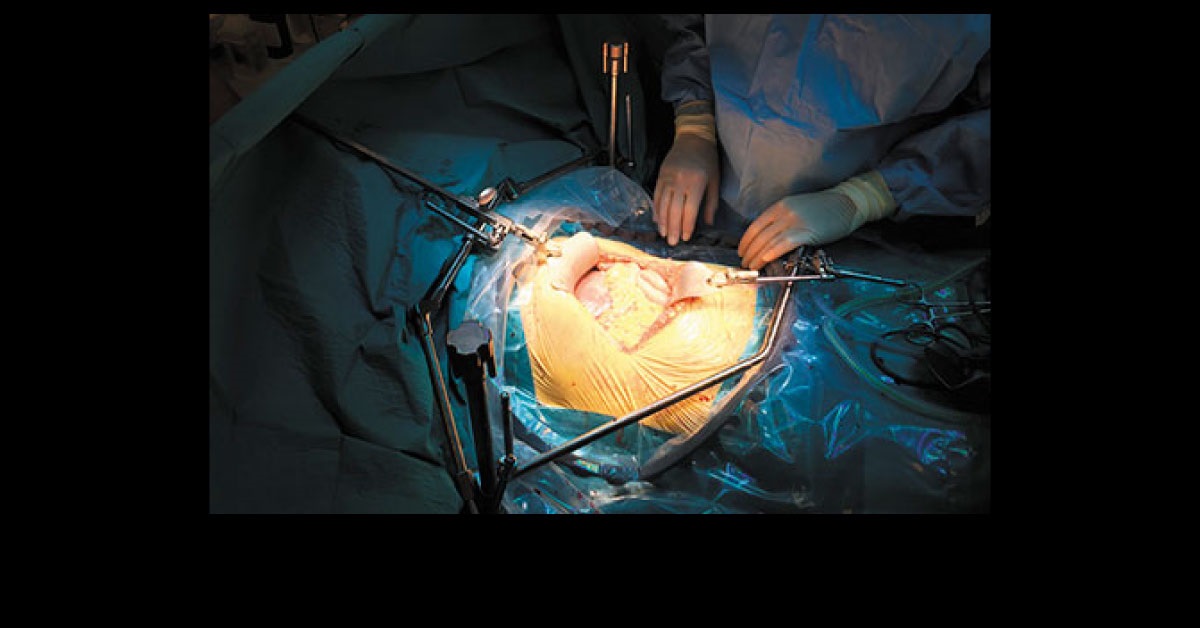 Postoperative Pain Management