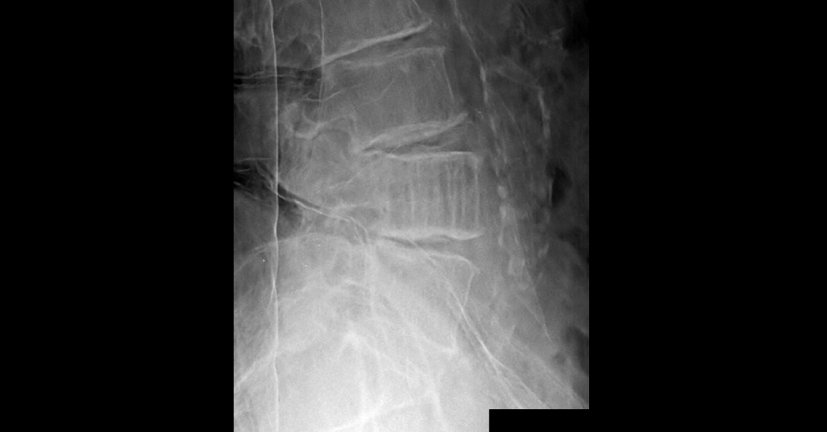 Conclude This From Given Radiograph