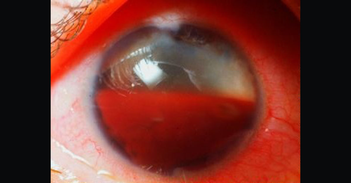Spot The Ophthalmic Condition