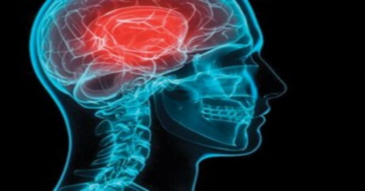 Treating Concussions, Practice Essentials