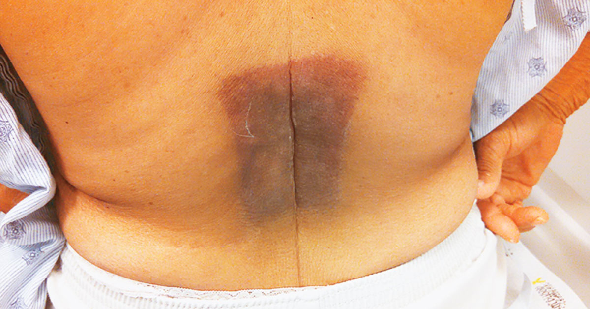 Identify The Cause Of This Condition In The Woman
