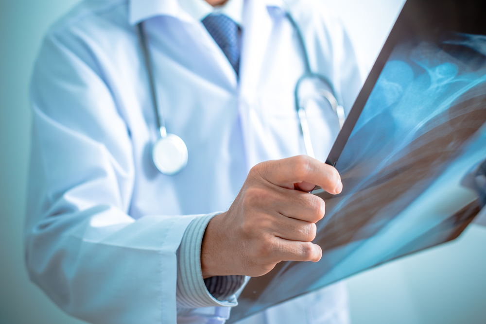 Radiological Imaging Of Blunt Diaphragmatic Lesions