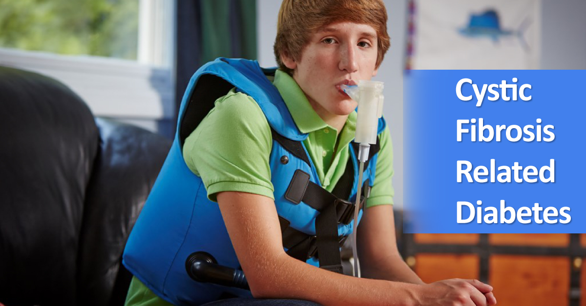 Cystic Fibrosis Related Diabetes Mellitus, Key Features And Management