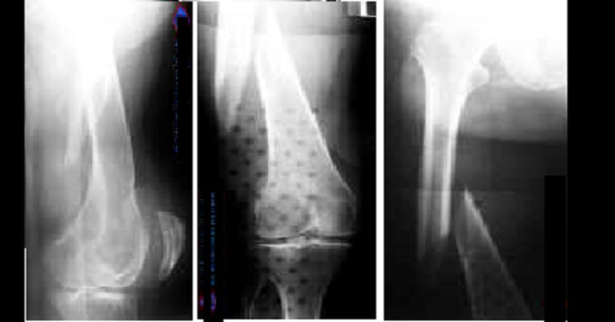 Interpret The Radiological Findings