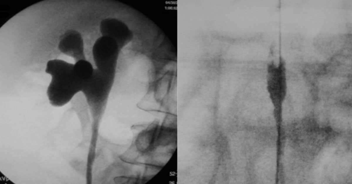 Conclude Most Likely Diagnosis From The Radiograph