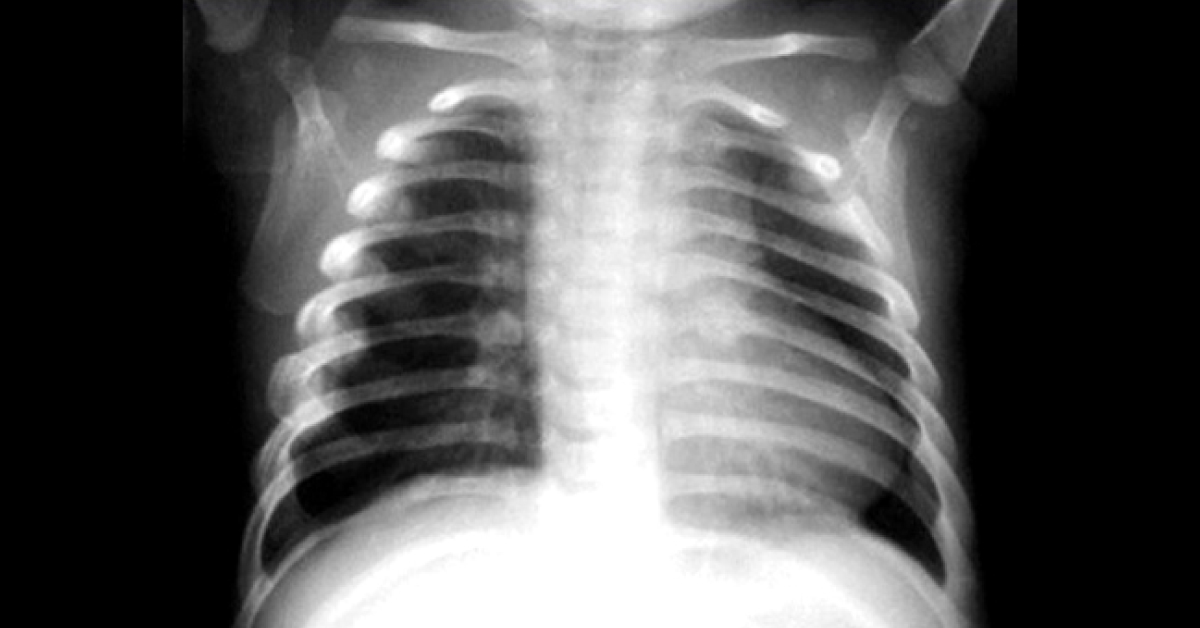 Interpret These Radiologic Findings