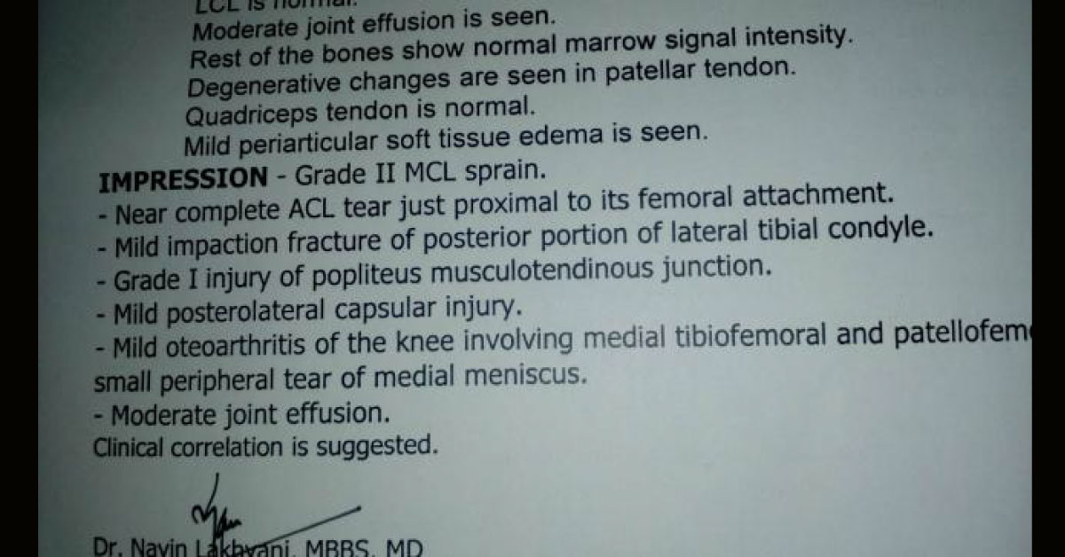 ACL injury