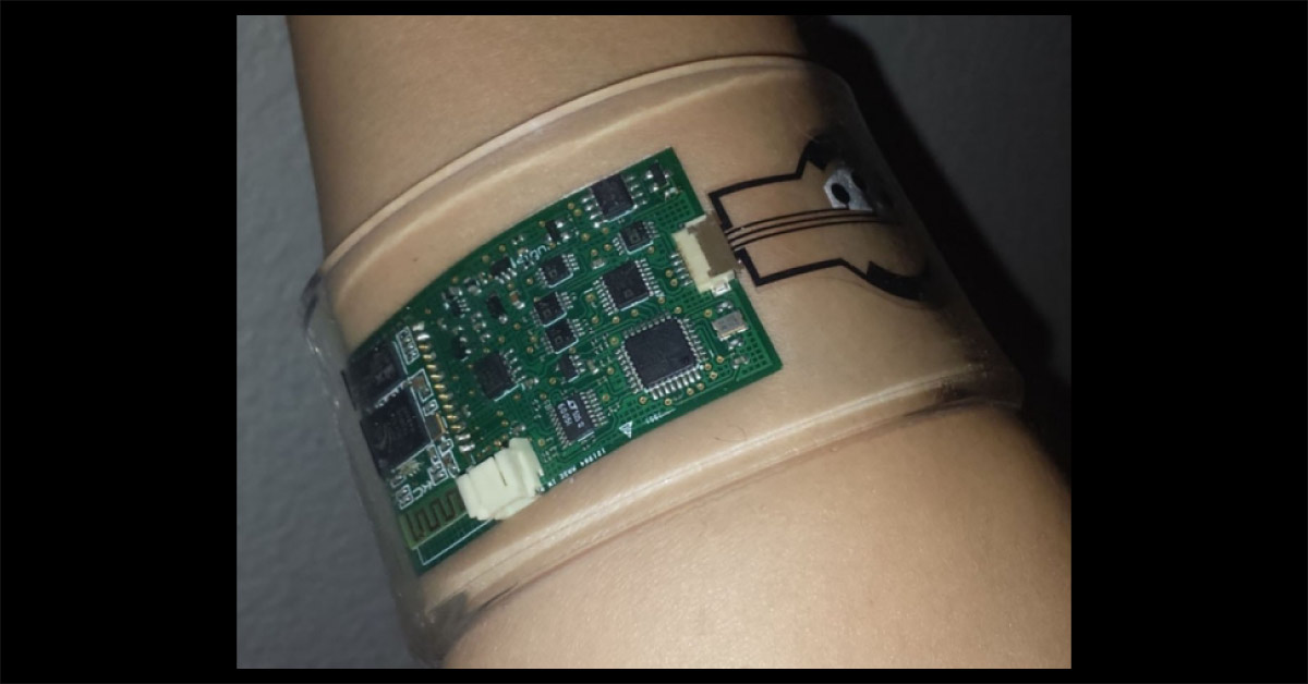 Low Cost Wearable Device To Monitor Diabetes Through Sweat
