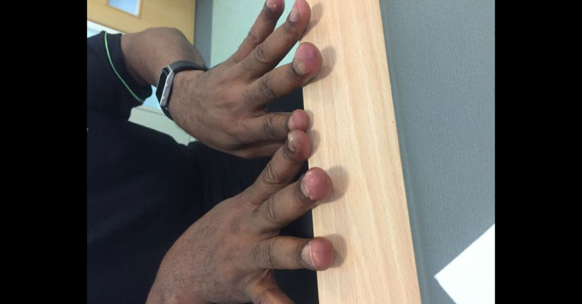 Request for Differential Diagnosis And Workup