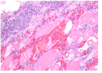 Identify The Condition