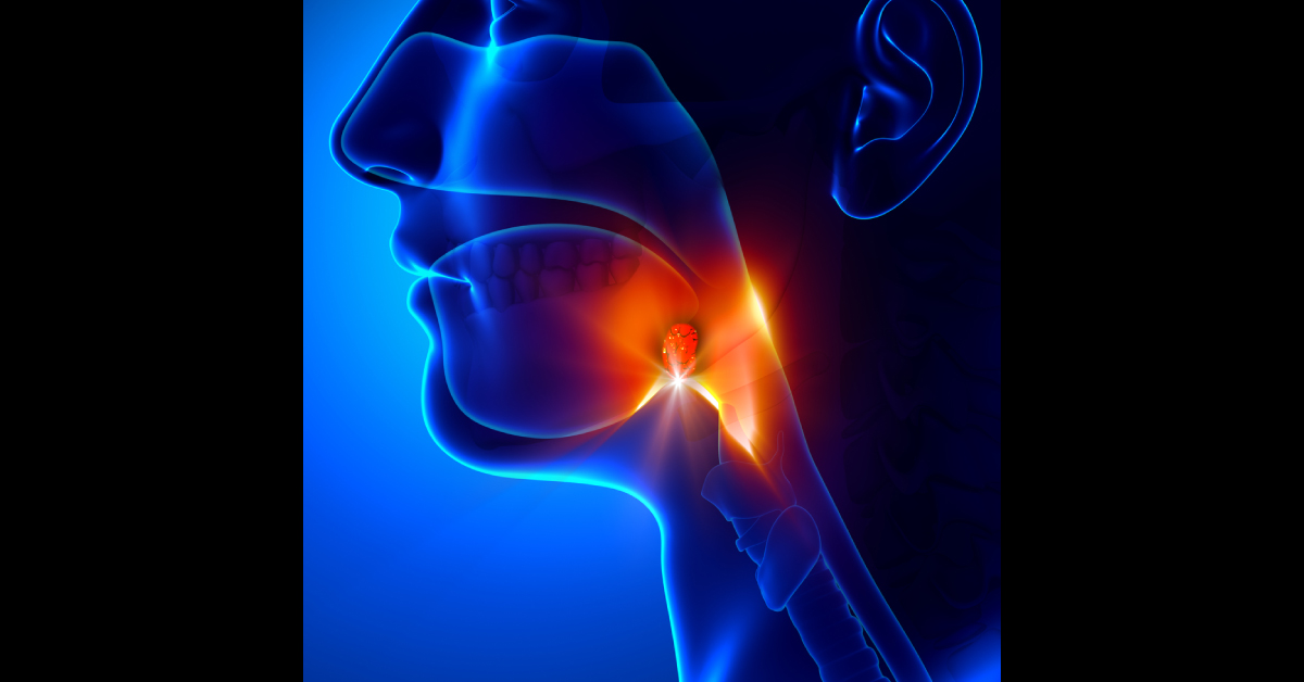 Drugs For Typhoid Fever