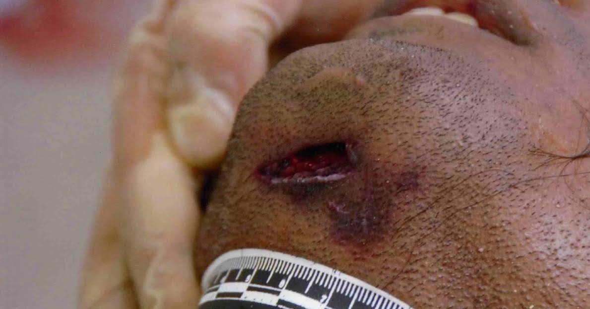 Identify The Lesions