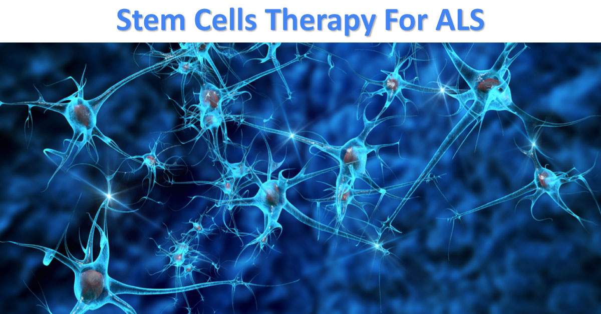 iPSCs, Novel Therapeutic Approach For ALS