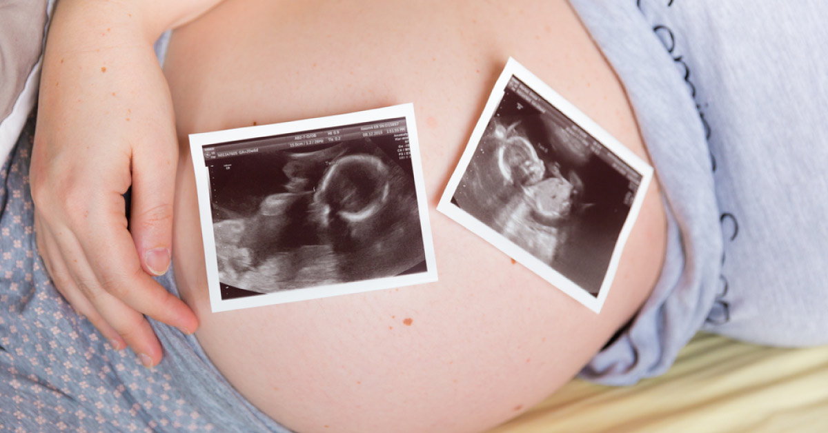 Multiple Pregnancy And Associated Risks Management
