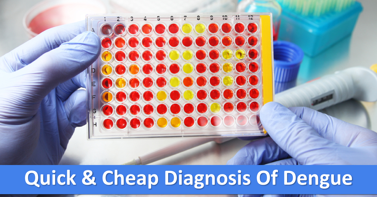 Biosensor Developed For Quick And Cheap Diagnosis Of Dengue