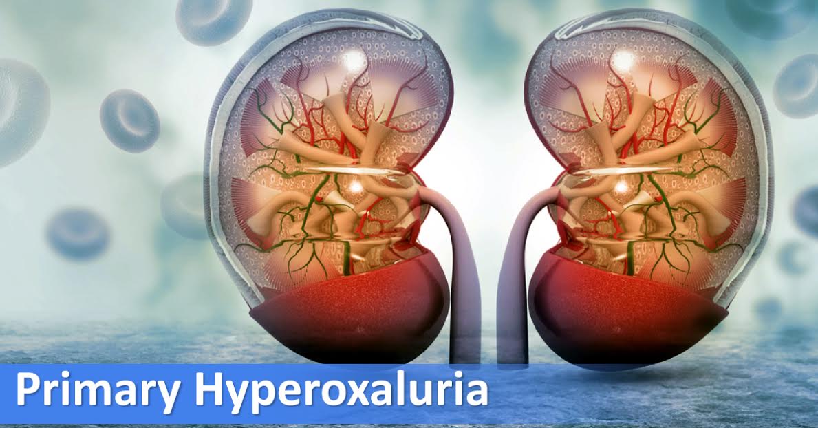 Management Of Primary Hyperoxalurias
