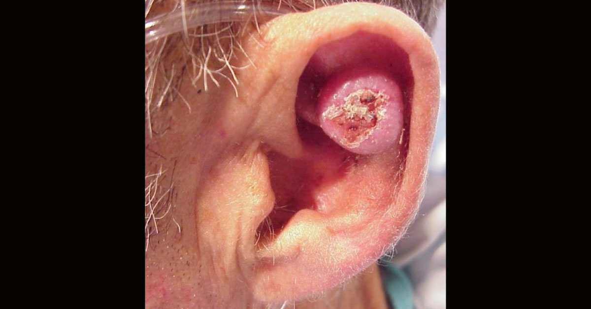 Recognize The Dermal Condition
