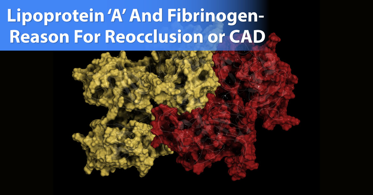 Lipoprotein ‘A’ And Fibrinogen- Neurologist And Cardiologist To Remember