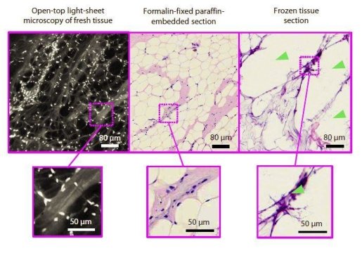 Microscope With 3D Image Will Replace Frozen & Open Biopsy During Cancer Surgery