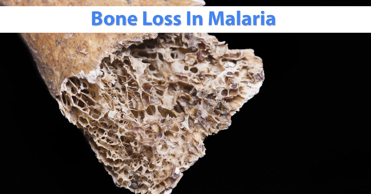 Can Malaria Induce Chronic Bone Loss?