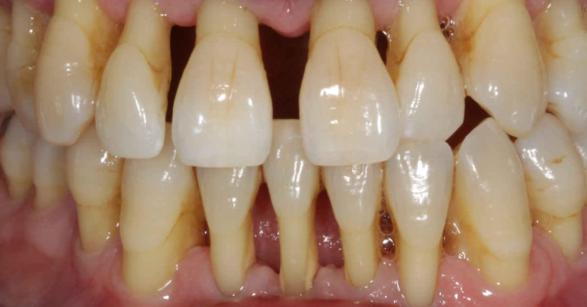 Diagnose This Dental Disorder